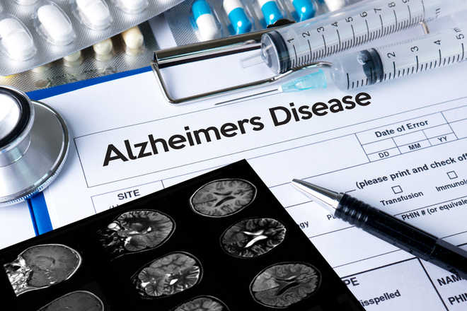 Researchers give insights into possible cause of Alzheimers disease